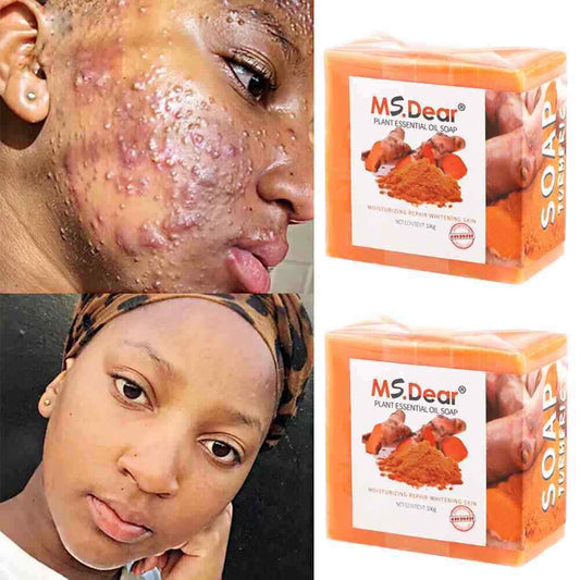 2× Turmeric Soap Skin Whitening Dark Spots Lightening Acne Brightening Turmeric
